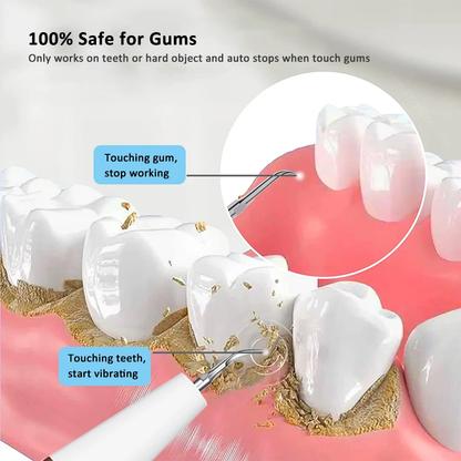 Ultrasonic Dental Calculus Scaler For Teeth Tartar Stains